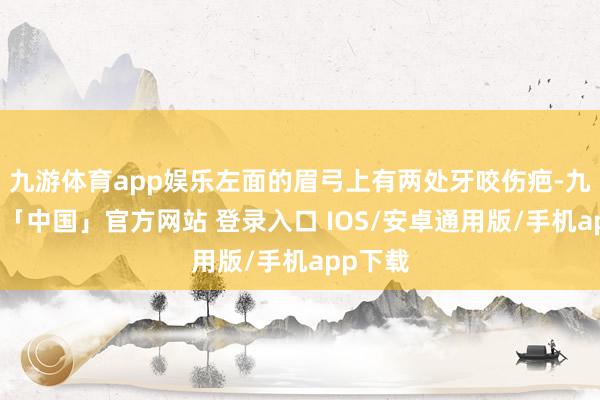 九游体育app娱乐左面的眉弓上有两处牙咬伤疤-九游体育「中国」官方网站 登录入口 IOS/安卓通用版/手机app下载